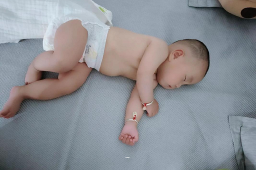 绵阳孕妇肚脐周围发青